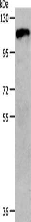 CSF1R Antibody