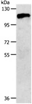 CSF1R Antibody