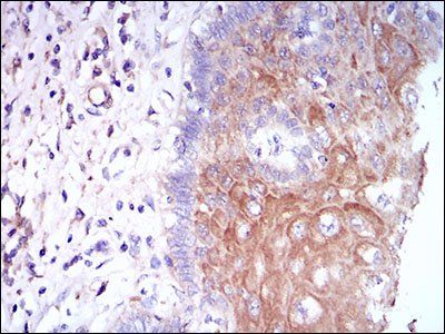 CSF1R Antibody