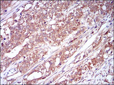 CSF1R Antibody