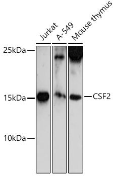 CSF2 antibody