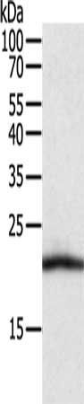 CSF2 antibody