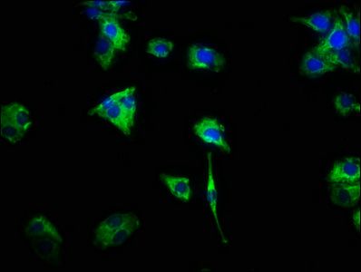 CSF2RA antibody