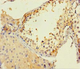 CSF2RA antibody