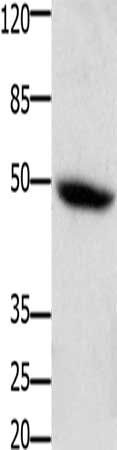 CSF2RA Antibody