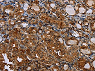 CSF2RA Antibody