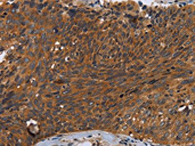 CSF2RA Antibody