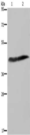 CSF2RA antibody