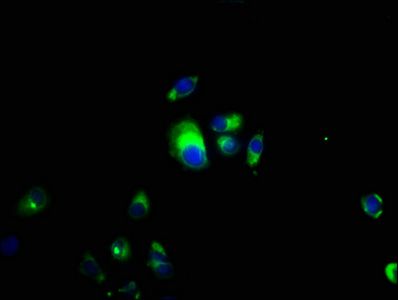 CSF2RB antibody