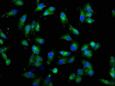 CSF2RB Antibody