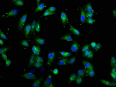 CSF2RB antibody