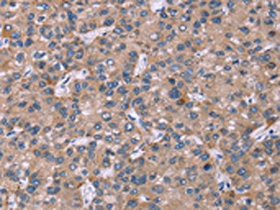 CSF2RB Antibody