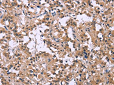 CSF2RB Antibody