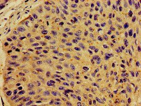 CSF2RB Antibody