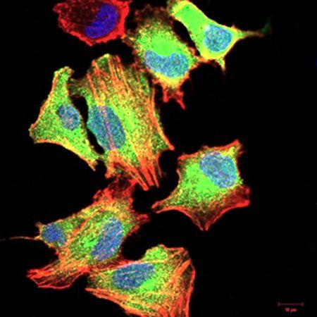 CSF3 Antibody