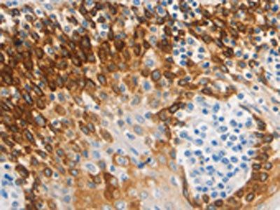 CSF3 Antibody