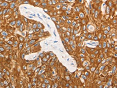 CSF3 Antibody