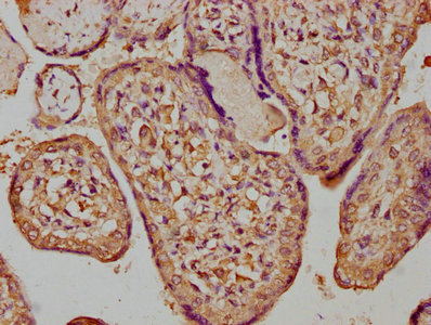 CSF3R antibody