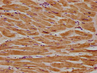 CSF3R antibody