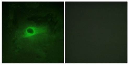 CSFR (Ab-809) Antibody