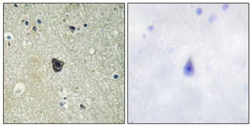 CSFR (Ab-809) Antibody