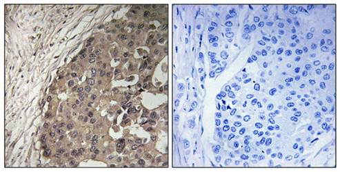 CSGALNACT1 Antibody