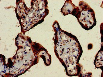 CSH2 Antibody