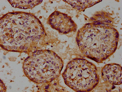 CSK Antibody