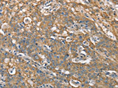 CSMD1 Antibody