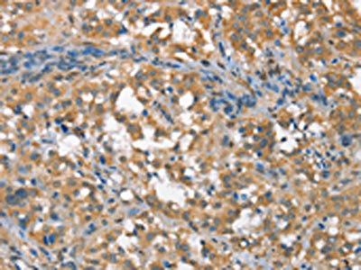 CSMD1 Antibody