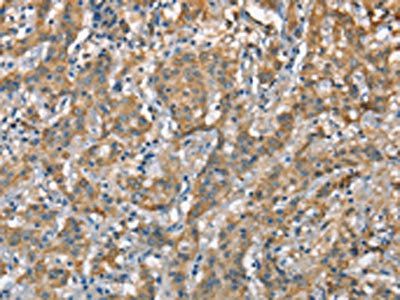 CSMD1 Antibody