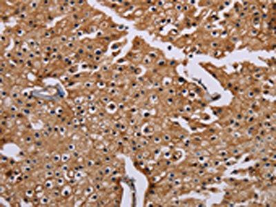 CSNK1A1 Antibody