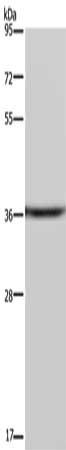 CSNK1A1 Antibody