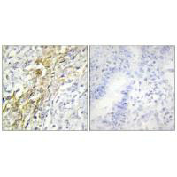 CSNK1A1 Antibody