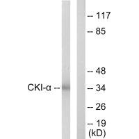 CSNK1A1 Antibody