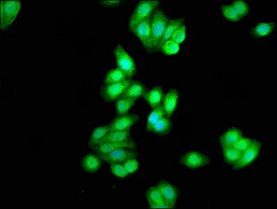 CSNK1D Antibody