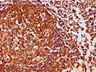 CSNK1D Antibody
