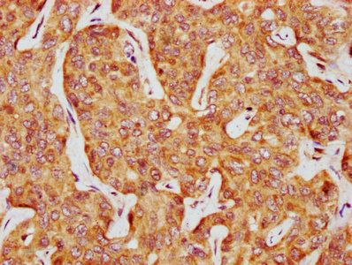 CSNK1D Antibody