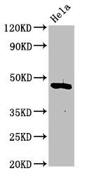 CSNK1D Antibody