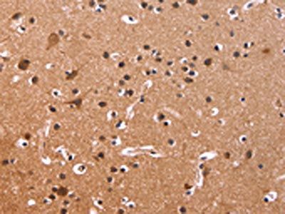 CSNK1D Antibody