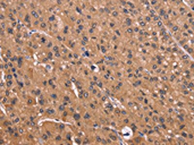 CSNK1D Antibody