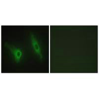 CSNK1E Antibody