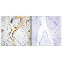 CSNK1E Antibody