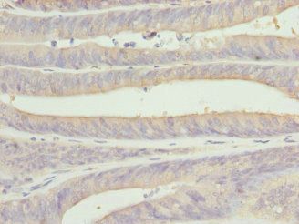 CSNK1G1 Antibody
