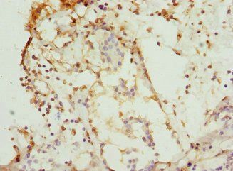 CSNK1G1 Antibody