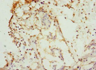 CSNK1G1 antibody