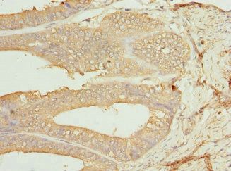 CSNK1G1 Antibody