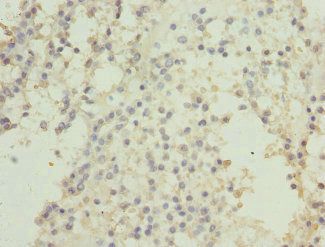 CSNK1G2 Antibody