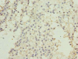 CSNK1G2 antibody