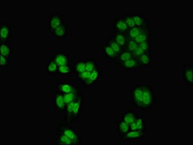 CSNK2A1 Antibody